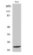 Western blot analysis of various cells using Di-Ras1 polyclonal antibody STJ92718