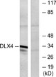 Western blot analysis of lysates from COLO cells using DLX4 Antibody. The lane on the right is blocked with the STJ92724