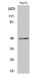 Western Blot analysis of various cells using E2F-2 Polyclonal Antibody with cells nucleus extracted by Minute™ STJ92808