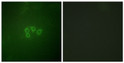 Immunofluorescence analysis of A549 cells, using eIF4B Antibody. The picture on the right is blocked with the synthesized peptide.