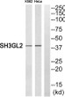 Western blot analysis of SH3GL2 Antibody. The lane on the right is blocked with the SH3GL2 peptide.