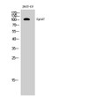 Western blot analysis of 293T-UV cells using EphA7 polyclonal antibody diluted at 1:500 STJ92946