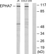 Western blot analysis of lysates from Jurkat cells and COLO205 cells, using EPHA7 Antibody. The lane on the right was STJ92946