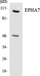 Western blot analysis of the lysates from HeLa cells using EPHA7 antibody. STJ92946