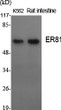 Western blot analysis of various cells using ER81 polyclonal antibody on cells' nuclei extracted by Minute™ cytoplasmic STJ92969