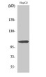 Western blot analysis of various cells using ERAP1 Polyclonal Antibody diluted at 1:500 STJ92971