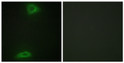 Immunofluorescence analysis of HepG2 cells using ERGI3 Antibody. The picture on the right is blocked with the STJ92985