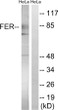 Western blot analysis of lysates from HeLa cells treated with paclitaxel 1uM 24h, using FER Antibody. The lane on the right is blocked with the synthesized peptide.