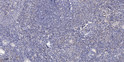 Immunohistochemical analysis of paraffin-embedded human tonsil. 1, Antibody was diluted at 1:200 (4°C overnight). 2, Tris-EDTA, pH9.0 was used for antigen retrieval. 3, Secondary antibody was diluted at 1:200 (room temperature, 30min).