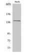Western blot analysis of various cells using GPR126 Polyclonal Antibody diluted at 1:500 STJ93332