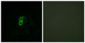 Immunofluorescence analysis of HUVEC cells, using GPR87 Antibody. The picture on the right is blocked with the synthesized peptide.
