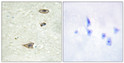Immunohistochemistry analysis of paraffin-embedded human brain tissue, using GRK1 Antibody. The picture on the right is blocked with the synthesized peptide.