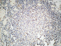Immunohistochemical analysis of paraffin-embedded Human Lymph gland. 1, Antibody was diluted at 1:100 (4°C overnight). 2, High-pressure and temperature EDTA, pH8.0 was used for antigen retrieval. 3, Secondary antibody was diluted at 1:200 (room temperature, 30min).