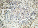 Immunohistochemical analysis of paraffin-embedded Human Lymph gland. 1, Antibody was diluted at 1:100 (4°C overnight). 2, High-pressure and temperature EDTA, pH8.0 was used for antigen retrieval. 3, Secondary antibody was diluted at 1:200 (room temperature, 30min).