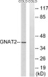 Western blot analysis of lysates from COLO cells, using GNAT2 Antibody. The lane on the right was blocked with the STJ93460