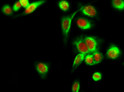 Immunofluorescence analysis of Hela cell. 1, HDAC6 Polyclonal Antibody (red) was diluted at 1:200 (4°C overnight). GFAP monoclonal antibody (5C8) (green) was diluted at 1:200 (4°C overnight). 2, Goat Anti Rabbit Alexa Fluor 594 Catalog: (NA was diluted at 1:1000 (room temperature, 50min). Goat Anti Mouse Alexa Fluor 488 Catalog: (NA was diluted at 1:1000 (room temperature, 50min).