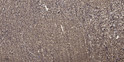 Immunohistochemical analysis of paraffin-embedded human tonsil. 1, Antibody was diluted at 1:200 (4° overnight). 2, STJ93509