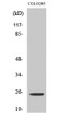 Western blot analysis of various cells using Hox-A7 Polyclonal Antibody cells nucleus extracted by Minute TM Cytoplasmic and Nuclear Fractionation kit (SC-003, Inventbiotech, MN, USA).