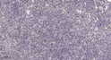 Immunohistochemical analysis of paraffin-embedded human spleen. 1, Tris-EDTA, pH 9.0 was used for antigen retrieval. 2, STJ93583