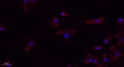 Immunofluorescence analysis of A549. 1, primary antibody (red) was diluted at 1:200 (4℃ overnight). 2, Goat Anti Rabbit STJ93592