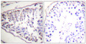 Immunohistochemistry analysis of paraffin-embedded human tonsil tissue, using HSL Antibody. The picture on the right is blocked with the synthesized peptide.