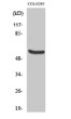 Western blot analysis of COLO205 cells using HSP60 Polyclonal Antibody diluted at 1：2000