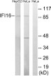 Western blot analysis of lysates from HeLa and HepG2 cells, using IFI16 Antibody. The lane on the right is blocked with the synthesized peptide.