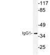 Western blot analysis of lysate from LOVO cells, using IgG1 antibody.