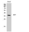 Western blot analysis of colo cells using IgG1 Polyclonal Antibody diluted at 1：500