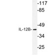 Western blot analysis of lysate from K562 cells, using IL-12B antibody.