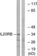 Western blot analysis of lysates from HeLa cells, using IL20RB Antibody. The lane on the right is blocked with the synthesized peptide.