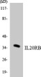 Western blot analysis of the lysates from COLO205 cells using IL20RB antibody.