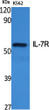 Western blot analysis of various cells using IL-7R Polyclonal Antibody Western blot analysis of various cells using IL-7R Polyclonal Antibody