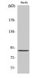 Western blot analysis of various cells using iPLA2γ polyclonal antibody diluted at 1:2000 STJ93748