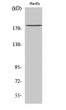 Western blot analysis of various cells using IQGAP3 Polyclonal Antibody diluted at 1:1000 STJ93753