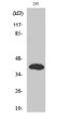 Western blot analysis of various cells using Islet-2 polyclonal antibody diluted at 1:500. Cell nucleus extracted by STJ93780