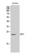 Western Blot analysis of Jurkat cells using JDP2 Polyclonal Antibody STJ93797