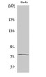 Western blot analysis of various cells using KALIG-1 polyclonal antibody STJ93813