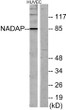 Western blot analysis of lysates from HUVEC cells, using NADAP Antibody. The lane on the right was blocked with the STJ93814
