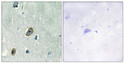 Immunohistochemistry analysis of paraffin-embedded human brain tissue, using KCIP1 Antibody. The picture on the right is blocked with the synthesized peptide.