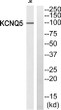 Western blot analysis of KCNQ5 antibody. The lane on the right was blocked with the KCNQ5 peptide. STJ93825