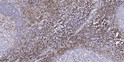 Immunohistochemical analysis of paraffin-embedded human tonsil. 1, Tris-EDTA, pH 9.0 was used for antigen retrieval. 2, STJ93829
