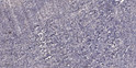 Immunohistochemical analysis of paraffin-embedded human tonsil. 1, Antibody was diluted at 1:200 (4°C overnight). 2, Tris-EDTA, pH9.0 was used for antigen retrieval. 3, Secondary antibody was diluted at 1:200 (room temperature, 45min).