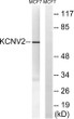 Western blot analysis of lysates from MCF-7 cells, using KCNV2 Antibody. The lane on the right was blocked with the STJ93880