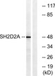Western blot analysis of lysates from HepG2 cells, using SH2D2A Antibody. The lane on the right was blocked with the STJ93883