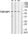 Western blot analysis of TOR1AIP1 antibody. The lane on the right is blocked with the TOR1AIP1 peptide. STJ93899