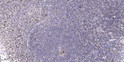 Immunohistochemical analysis of paraffin-embedded human tonsil. 1, Antibody was diluted at 1:200 (4° overnight). 2, STJ93924
