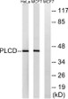 Western blot analysis of lysates from HeLa and MCF-7 cells, using AGPAT4 Antibody. The lane on the right was blocked STJ93947