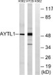 Western blot analysis of lysates from K562 and HT-29 cells, using LPCAT2 Antibody. The lane on the right was blocked STJ93950