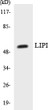 Western blot analysis of the lysates from HepG2 cells using LIPI antibody. STJ93951